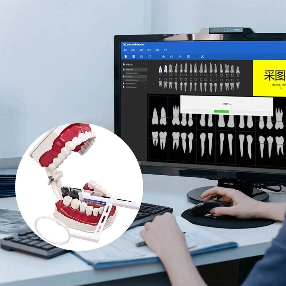 Dental Sensor X-Ray Digital Se - Medical X reseña y precio