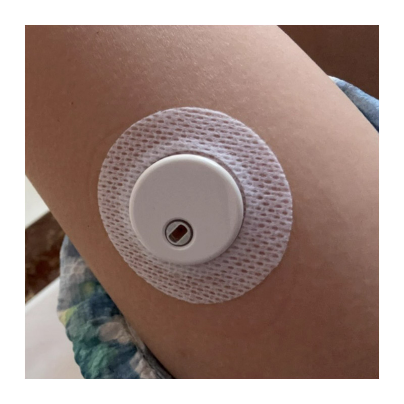 Original Linx sensor patches C - Medical X reseña y precio